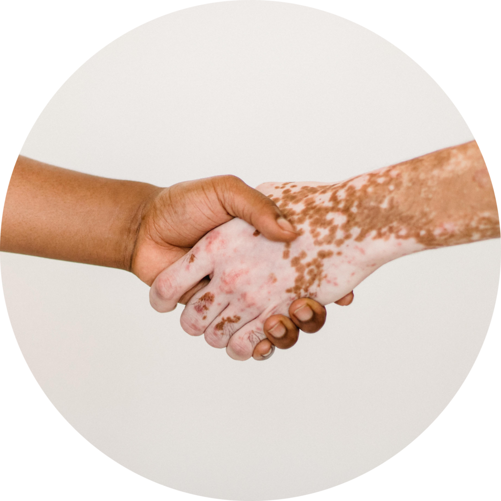 Hands clasped together in a handshake